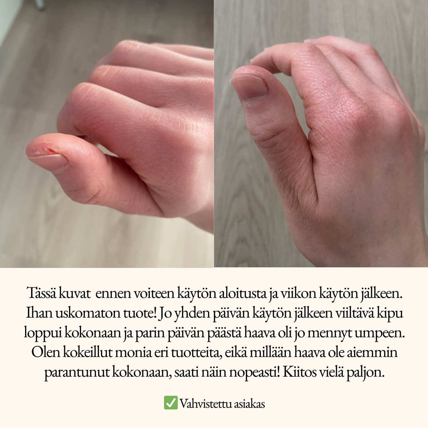 Herkkä iho ja ihonhoito: miksi enemmän ei ole parempi – ja mitä tehdä sen sijaan
